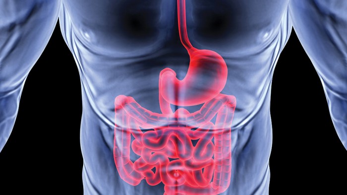 X-ray image of stomach (gut)